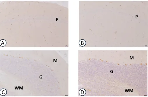 Figure 4. Sections of the CA1 subfields of hippocampus (A,B), cerebellum (C,D) processed for TNF-