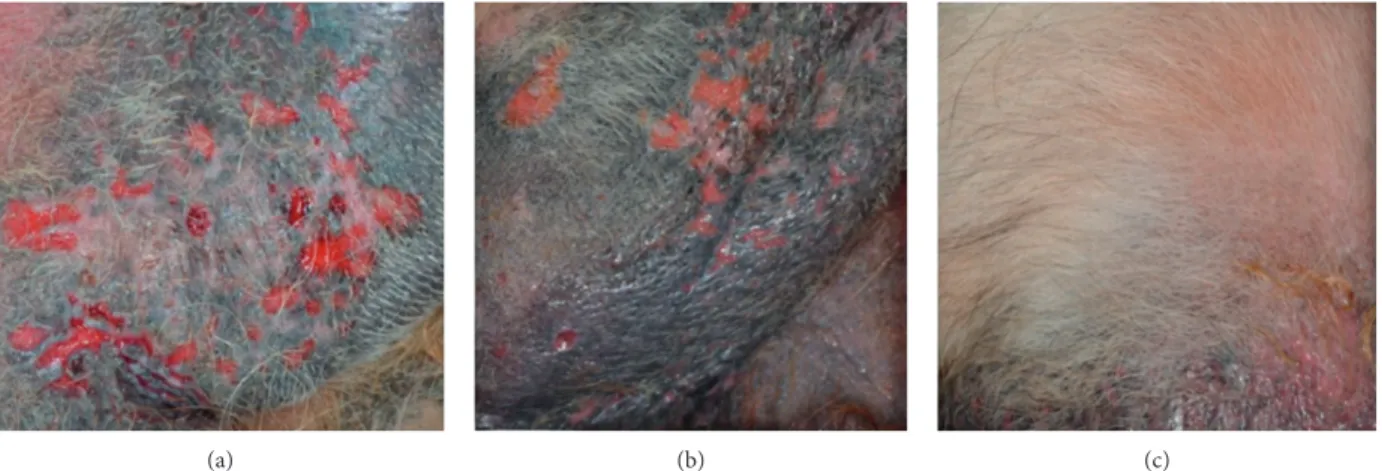 Figure 1: Group B case #8 clinical evaluation visit pictures. (a) Enrolment visit; (b) day 21 visit; (c) day 42 visit; clinical resolution was determined.