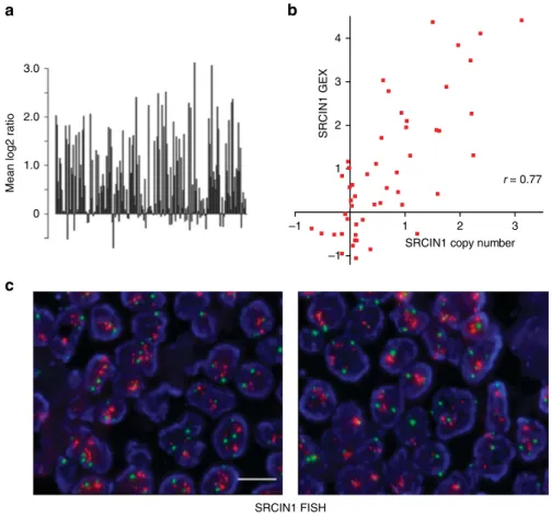 Figure 2 | SRCIN1 gene alterations in human ERBB2 breast cancer samples. (a) SRCIN1 gene copy number across 200 ERBB2-ampliﬁed breast cancer samples analysed by aCGH