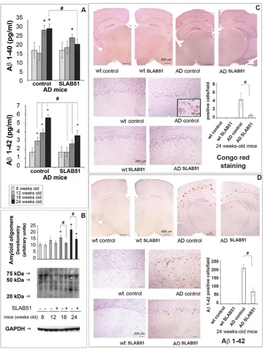 Figure 5. Aβ load. Panel A: Aβ 1–40  and Aβ 1–42  levels expressed as pg/ml determined by ELISA in the brains of AD  mice treated or not with SLAB51 (n = 8)