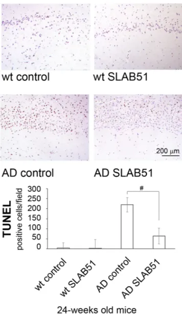 Figure 8.  TUNEL detection of apoptotic neurons in hippocampal area of SLAB51 treated and untreated AD  and wt mice