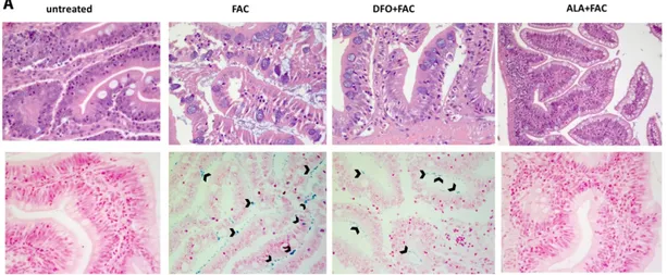 Figure 5. ALA protected against histopathological alterations and iron stores induced by iron 