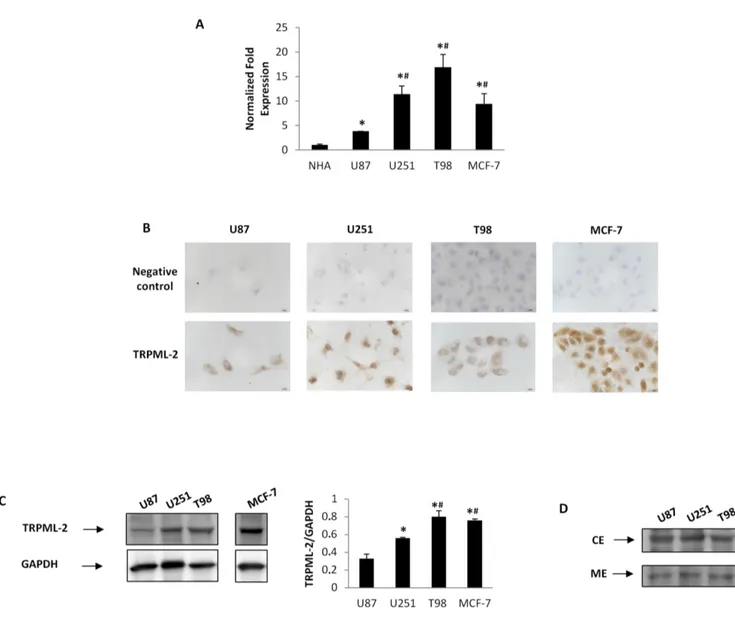 Figure 4: TRPML-2 mRNA and protein expression in high-grade glioma cell lines.   A.  The  relative  TRPML-2  mRNA  expression in NHA, U87, U251 and T98 glioma cell lines and in MCF-7 breast cancer cell line used as positive control was evaluated by  qRT-PC