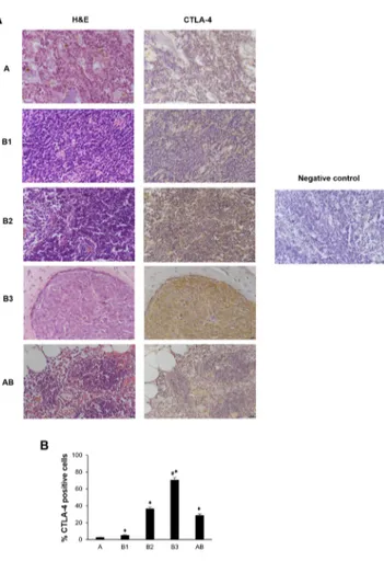 Figure 2: CTLA-4 protein expression in different subtypes of thymoma tissues.  (A) Sections of A, B1, B2, B3 and AB  thymomas A were processed for hematoxylin and eosin staining (right column) and for CTLA-4 (left column) by immunohistochemistry