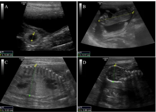 Figure 1. Representative ultrasonographic scans of biometry measurements recorded during preg-