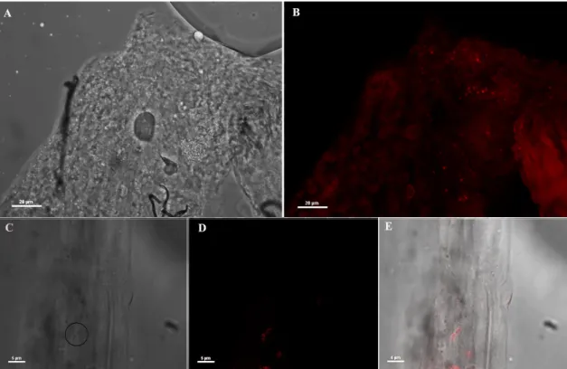 Figure 1. Immunofluorescence assay (IFA)  on mosquito midguts using anti-Asaia monoclonal  antibody (mAb)