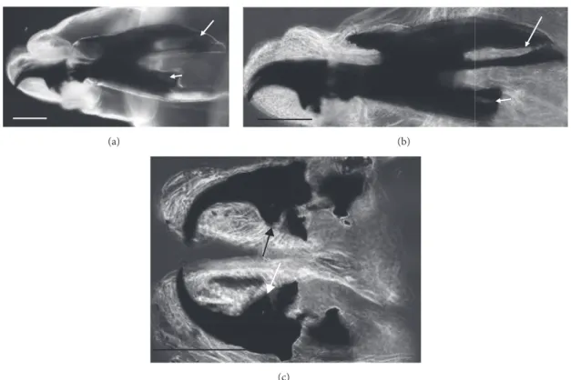 Figure 3: Sarcophaga third instar larva: LM image: (a) cephaloskeleton with dorsal cornua showing window apparently 8-shaped (arrow) while the ventral cornua window is smaller but still well developed (arrowhead)