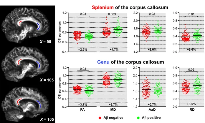 Fig. 3 Microstructural biomarkers in patients with amnestic mild cognitive impairment (aMCI) enrolled in the European