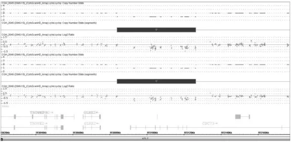 Figure  5b.  CytoScan  HD  Array  analysis  results  of  the  patients  (proband  and  mother)