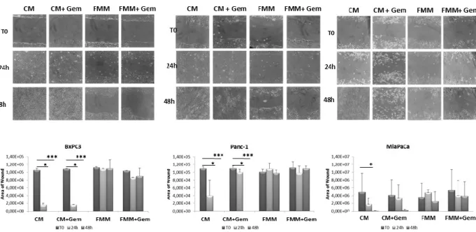 Figure  4.  Wound  healing  assay.  Cell  migration  of  BxPC3,  PANC-1  and  MIAPaCa-2  upon 