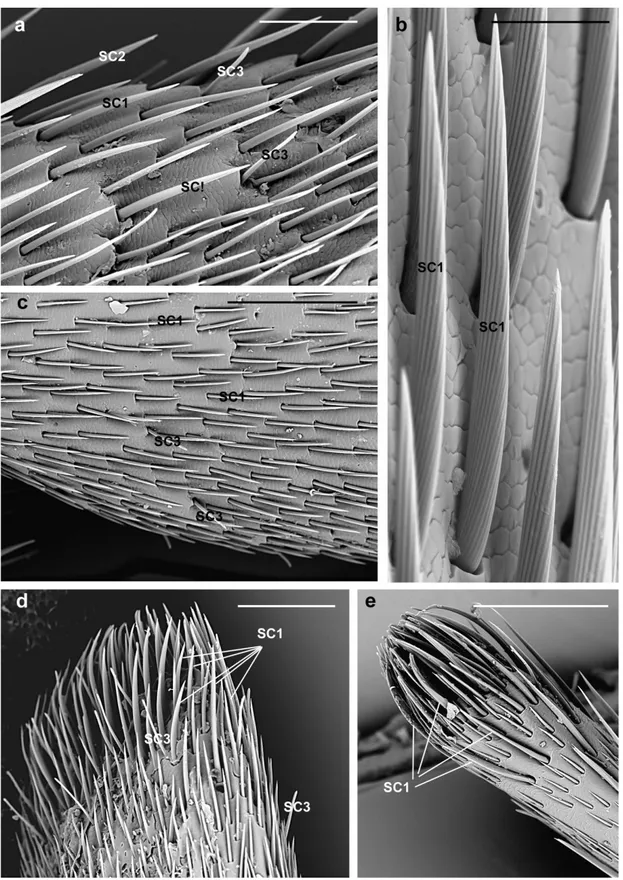 Figure 3. A. bungii, SEM. Sensilla chaetica SC1. (a) Overview of SC1 on the female second flagellomere