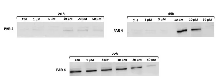Figure 11: Curcumin reduces promotes apoptosis. Variation in level expression of PAR4 showed at  24 hours (a), 48 hours (b) and 72 hours (c)