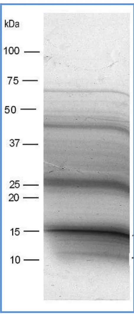 Fig. 5. SDS-PAGE of fennel extract and protein separation according to their molecular  weight