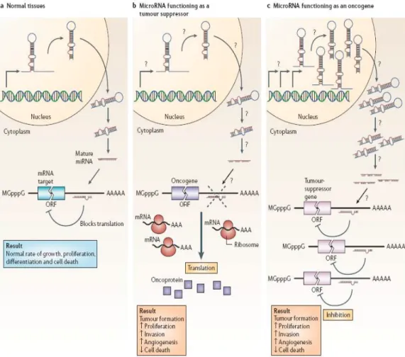 Figura  4.  Funzione  dei  MicroRNA  come  Oncogeni  e  geni  Oncosoppressori (modificato da Esquela Kerscher A &amp; Slack FJ