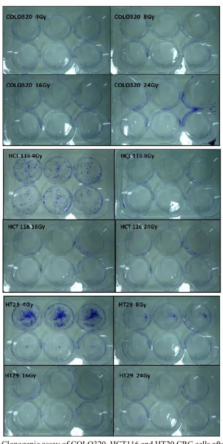 Fig. 13- Clonogenic assay of COLO320, HCT116 and HT29 CRC cells after 4, 8,                16 and 24 Gy