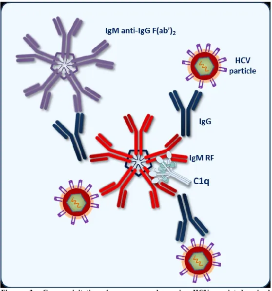 Figure  3.  Cryoprecipitating  immune  complexes  in  HCV-associated  mixed  cryoglobulinemia