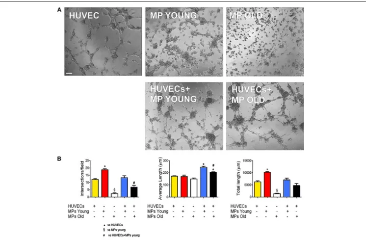 FIGURE 2 | Ability of MP to form capillary-like structures in vitro.