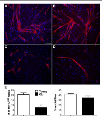FIGURE 4 | PEG-fibrinogen re-establishes the myogenic capability of adult MP. (A,B) Confocal images of immunofluorescence labeling with an