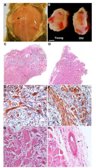 FIGURE 5 | PEG-fibrinogen-pericyte constructs form ectopic muscle