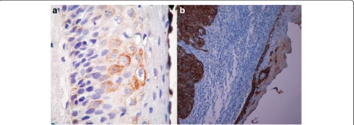 Fig. 3 CK19 staining expression and localization in perilesional mucosa in HPV − /HPV + cancers