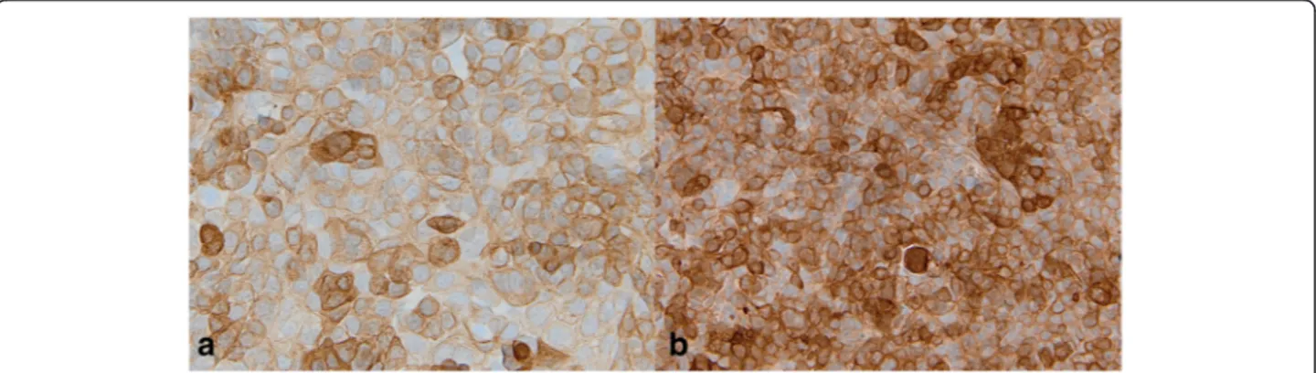 Fig. 5 Immunocytochemical expression of CK19 in HPV − OSCC cell line (SCC-131) and in HPV + OSCC cell line (SCC-154)