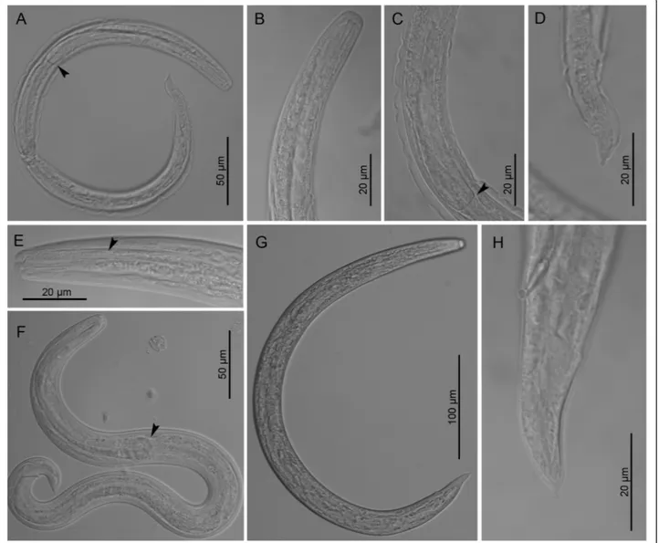 Fig. 3 Third stage larvae of Crenosoma vulpis at different days post-infection (dpi), lateral view