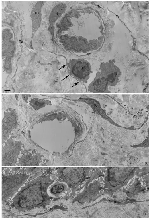 Figure 4. Transmission electron microscopy micrograph of pterygium. Elongated telocyte-like cells scattered in the stroma and around blood  vessels were observed (A, B)
