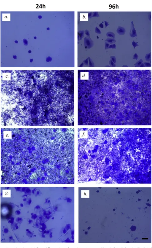 Fig. 7. Comassie staining of SaOS-2 after 2 different times of growth, on glass control (a, 24h; b, 96h), bare biosilica (c, 24h; d, 96h), ALE-biosilica (e, 24h; f, 96h) and Na ALE free drug (g, 24h; h, 96h)