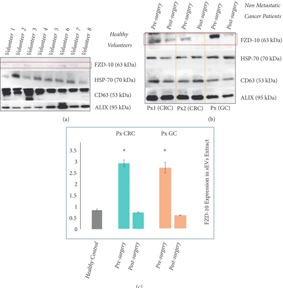 Figure 2: Detection and determination of FZD-10 expression levels in sEVs isolated from healthy donors and nonmetastatic cancer patients by
