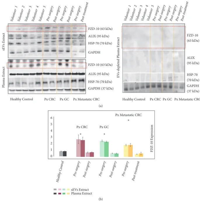 Figure 4: Detection and determination of FZD-10 expression levels in sEVs and in whole plasma samples of healthy donors and cancer patients by