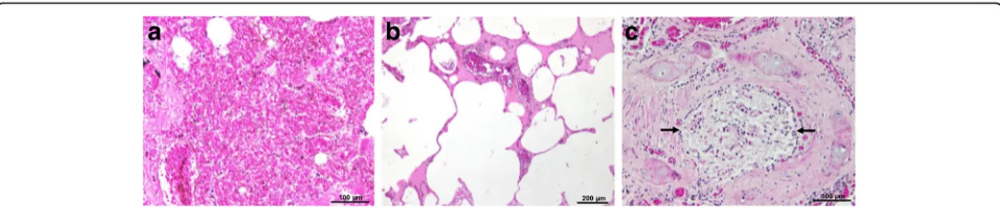 Fig. 4 Histopathology of the lungs of a South African fur seal, stained with haematoxylin and eosin