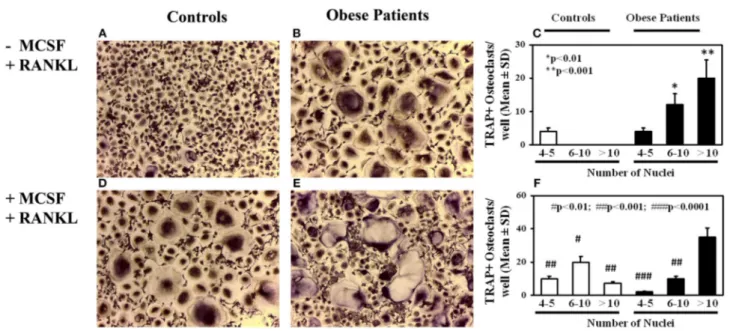 FIGURE 1 | Osteoclastogenesis in obese subjects. Osteoclasts (OCs) identified as tartrate-resistant acid phosphatase-positive (TRAP + ) and multinucleated cells with three or more nuclei, differentiated from peripheral blood mononuclear cells (PBMCs) of ob