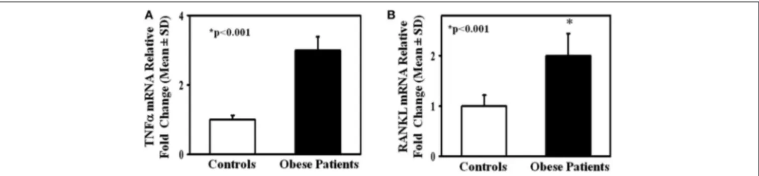 FIGURE 3 | TNFα and RANKL expression in lymphomonocytes from obese subjects. mRNA levels of TNFα (A) and RANKL (B) in lymphomonocytes from all enrolled controls and obese subjects