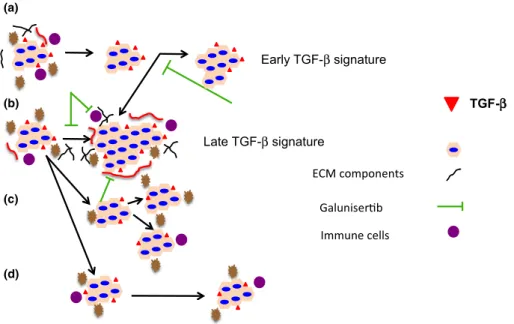 Figure 4 Effects of inhibiting the TGF-b pathway in HCC progression. Early TGF-b signature tumours progress slowly in the presence of TGF-b and are insensitive to the inhibition of this pathway