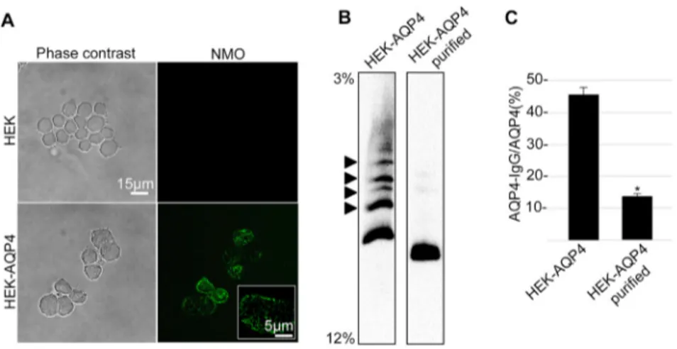 Fig. 6. AQP4 supramolecular structure in HEK-293F human cells. A) Phase contrast images (Phase contrast) and immunoﬂuorescence analysis performed with AQP4 IgG containing NMO serum (NMO) on His-tagged AQP4 expressing HEK-293F human cells (HEK-AQP4) and unt