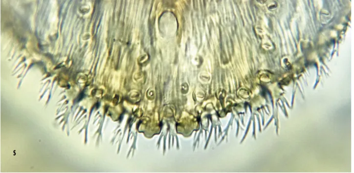 FIGURE 3. s) Aspidiotus bornmuelleri Lindinger, margin of adult female pygidium viewed from dorsum; t) taxonomic  illustration of pygidium of the adult female A