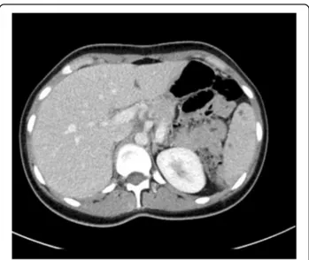 Table 1 Main causes of splenic abscesses