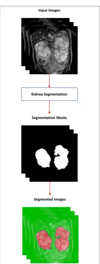 Fig. 1 Workflow for the semantic segmentation starting from the full image