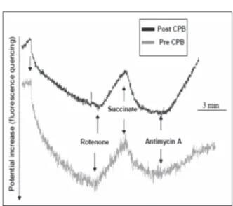 Figure 3. ROS measurements performed to prove the ox- ox-idative damage and the relevant alteration of mitochondrial  respiratory chain activity induced by post-CBP serum  ad-dition to human fibroblasts