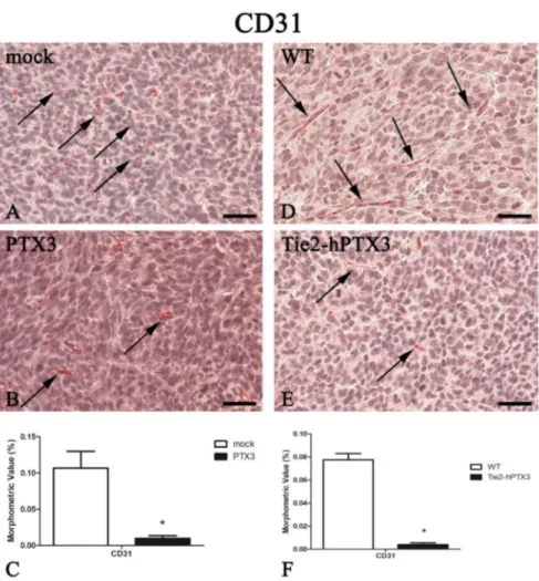 Figure 2. PTX3 overexpression reduces angiogenesis. CD31 immunohistochemistry and morphometric analysis in mock (A) and PTX3 (B) transfected MC17-51 tumor grafts growing s.c