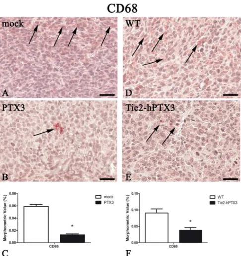 Figure 4. PTX3 overexpression reduces CD68-positive macrophages infiltrate. CD68 immunohistochemistry and morphometric analysis in mock (A) and PTX3 (B) transfected MC17-51 tumor grafts growing s.c