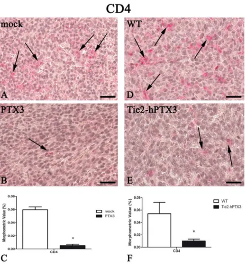 Figure 5. PTX3 overexpression reduces CD4-positive T-lymphocytes infiltrate. CD4 immunohistochemistry and morphometric analysis in mock (A) and PTX3 (B) transfected MC17-51 injected s.c