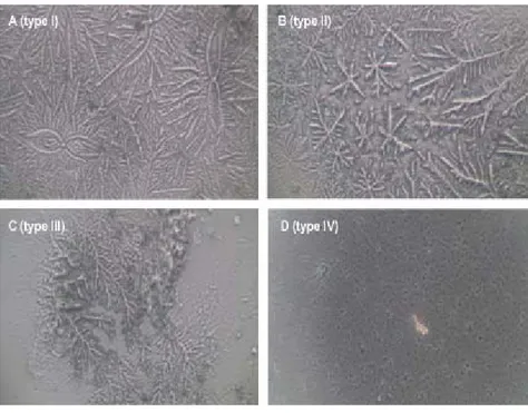 Figure 1. The four grades  of nasal ferning taken at  100x magniﬁ cation,  classi-ﬁ ed from type I to type IV  according to the Rolando  scoring