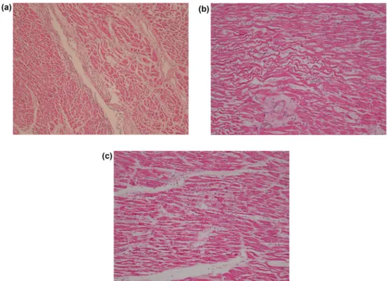 Fig. 5. Histopathology of the left myocardium: a) mild and focal polymorphonuclear leukocyte infiltrate (HE, 40 × ), b) wavy fibers (HE, 100 × ), c) contraction  band necrosis (HE, 100 × )