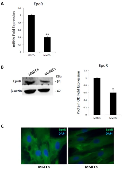 Figure 2: Bone marrow endothelial cells express Epo receptor.  (A) mRNA levels are analyzed by Real Time RT PCR and  normalized to GAPDH; fold increase of mRNA in MGECs versus MMECs as mean ± SD of 6 MGUS and 8 MM patients