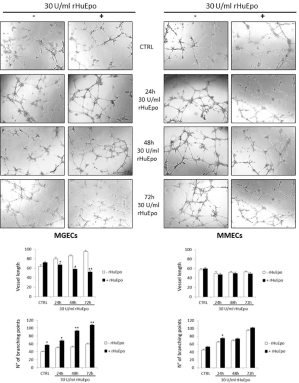 Figure 6: RHuEpo stimulates angiogenesis in vitro.  (A) Angiogenesis in vitro on Matrigel © 