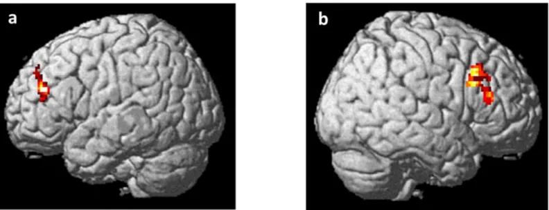 Fig 1. Rendered image of the brain depicting the dorsolateral prefrontal clusters whose activity correlated positively with apathy scores during (a) working memory and (b) attentional control tasks