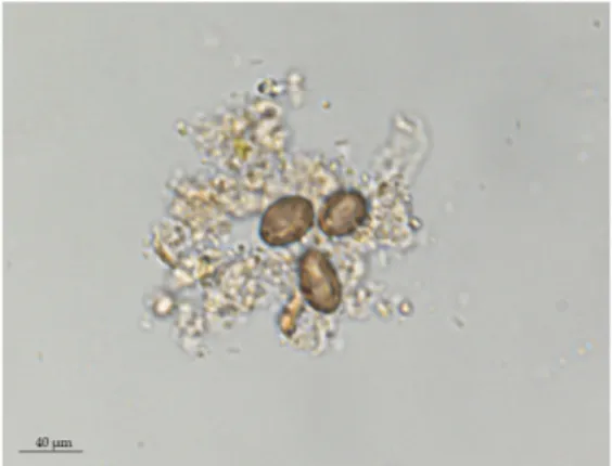 Figure 2. Coproscopy showing the A. caucasica eggs found in wild chimpanzee feces (formol-ether  method, 100× magnification)
