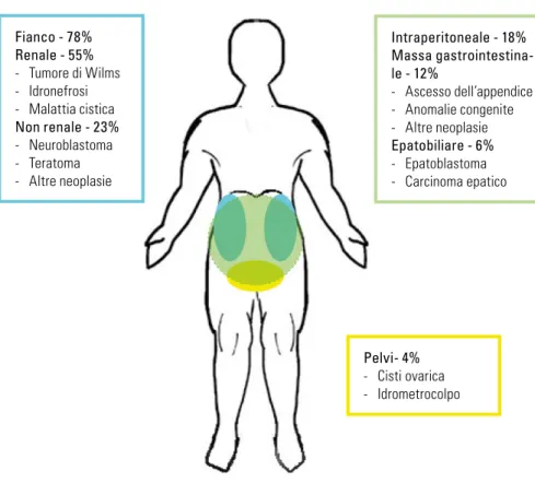 Figura 2. Masse del bambino adolescente per sede (riquadro azzurro: fianco; riquadro verde: intraperi- intraperi-toneale; riquadro giallo: pelvi).