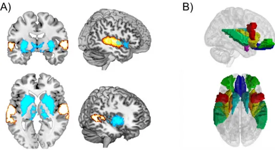Figure 2. The figure presents the consistent results of functional connectivity between brain reward  regions and auditory supratemporal regions during enjoyable music listening
